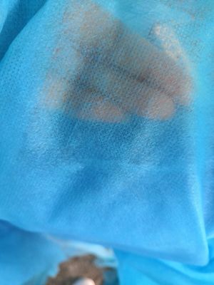 35gsm TNT PP Non Woven Fabric Spunbond Medical Disposable Clothes